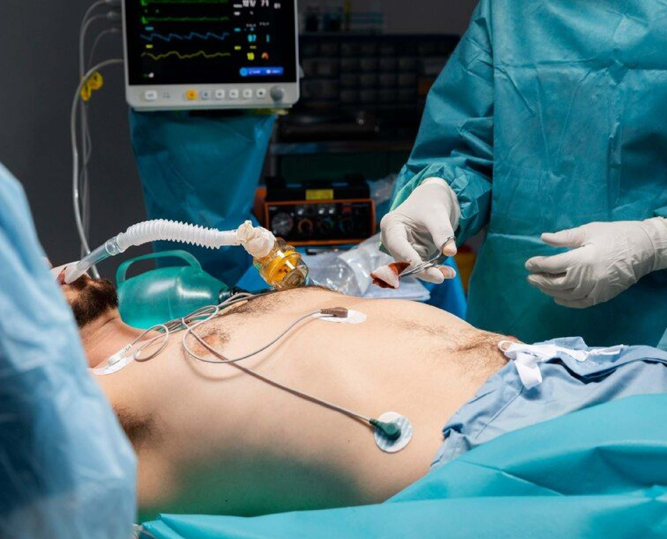 Kidney Cancer